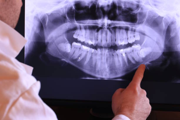 Best Cracked Tooth Emergency Dentist  in Edwardsville, KS