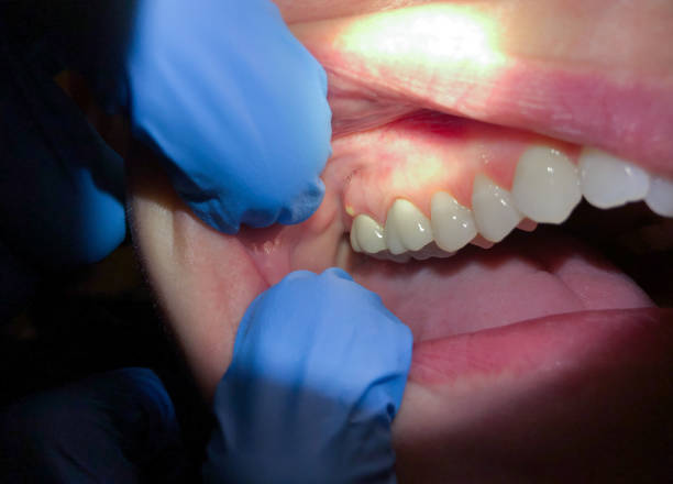 Best Emergency Dentist Near Me  in Edwardsville, KS