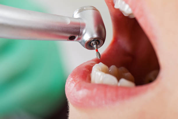 Best Emergency Tooth Extraction  in Edwardsville, KS